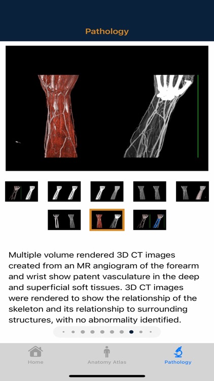 CTisus: CT of the Hand & Wrist screenshot-7