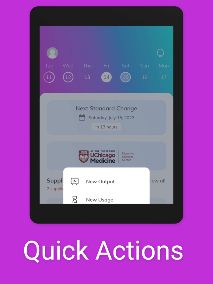 OstoBuddy Ostomy Companion