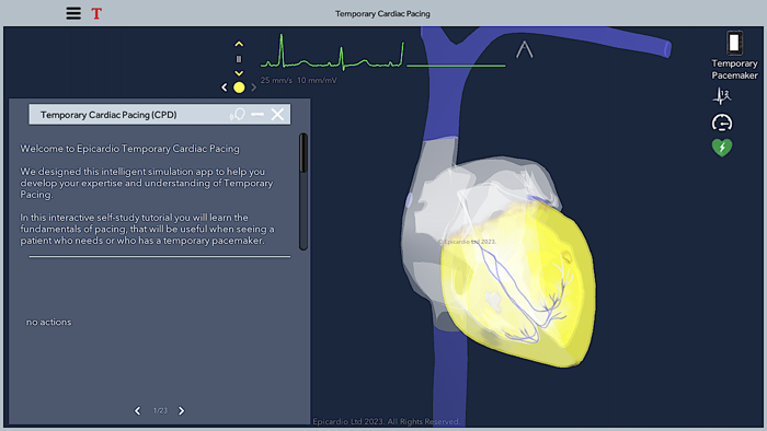 Temporary Cardiac Pacing