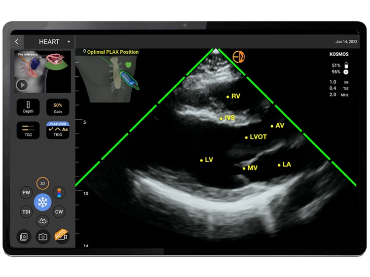 Kosmos Ultrasound