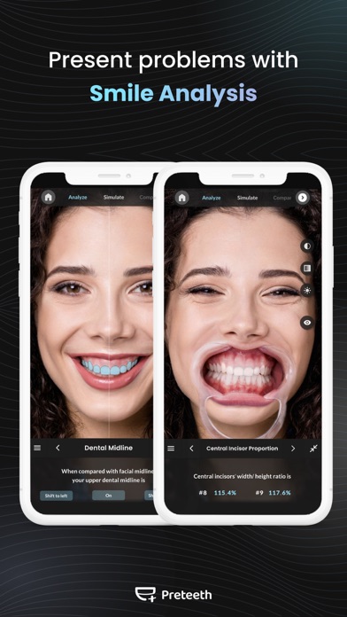 Preteeth AI Pro Screenshot
