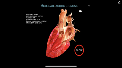 TheHeartPhysiologyApp Screenshot