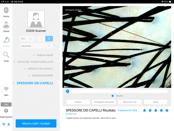 EODIS Hair and Scalp Scanner