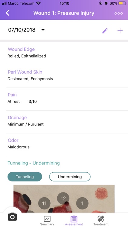 inSight AWM CR screenshot-3