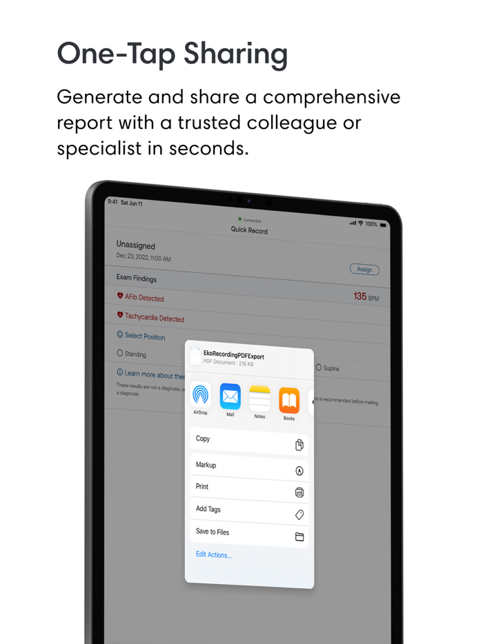 Eko Digital Stethoscope  ECG