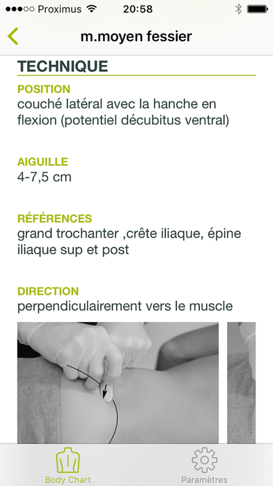 Screenshot #1 pour Dry Needling Guide