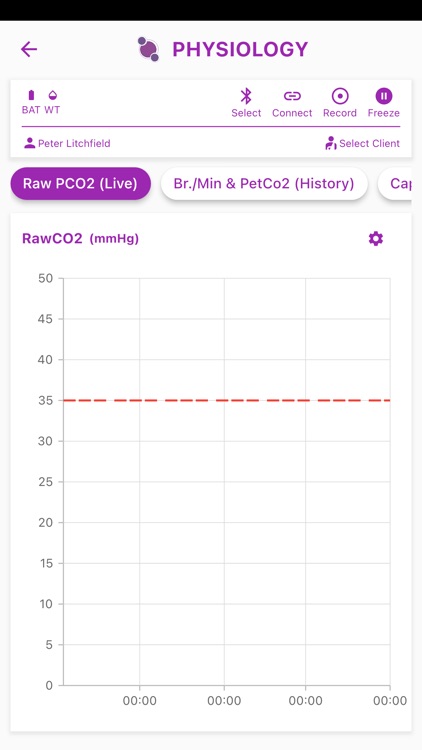CapnoTrainer screenshot-3