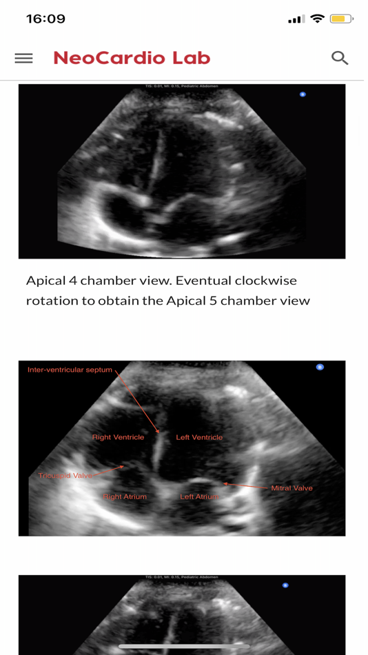 #2. NeoCardioLab (iOS) 由: gabriel altit