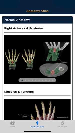 CTisus: CT of the Hand & Wrist screenshot 2
