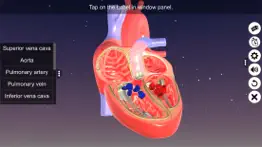 sections of human heart problems & solutions and troubleshooting guide - 1