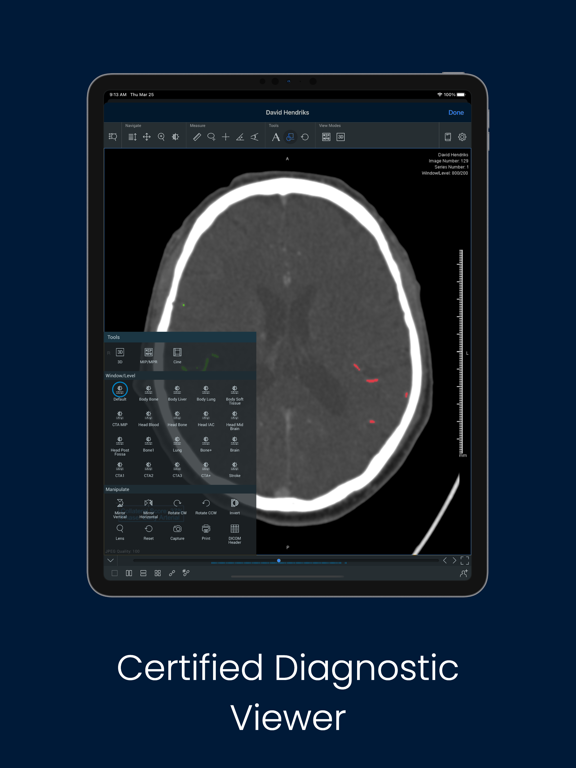 Screenshot #6 pour StrokeViewer
