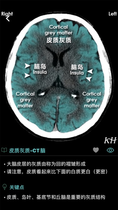 影像图谱のおすすめ画像8