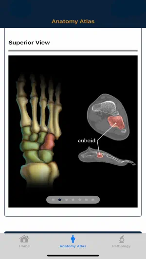 CTisus: CT of the Foot screenshot 3