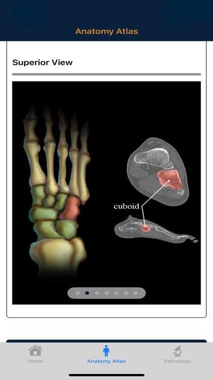 CTisus: CT of the Foot
