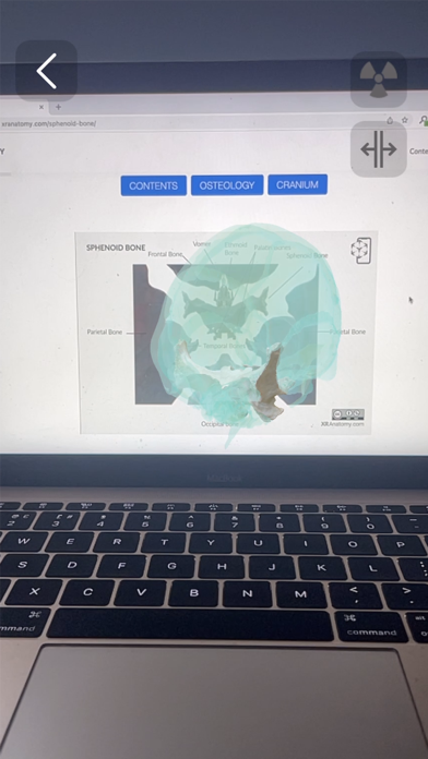 XR Anatomyのおすすめ画像4