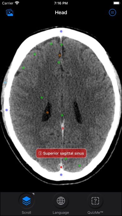 CT Anatomy Screenshot