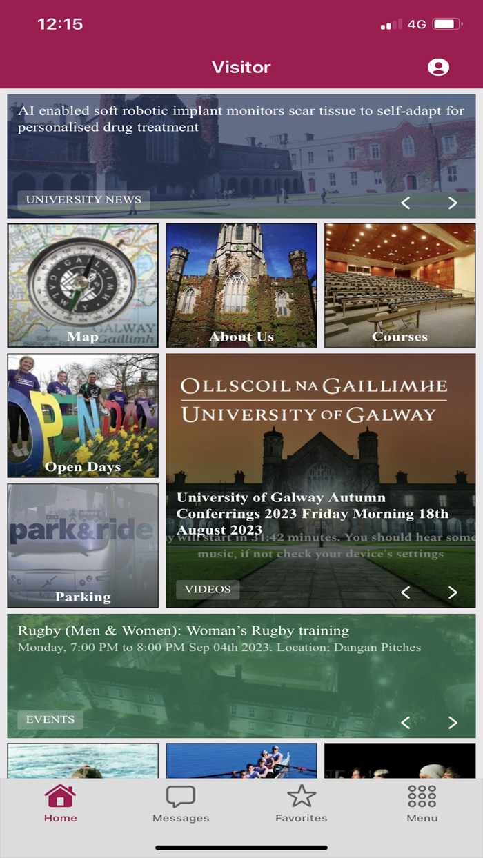 University of Galway