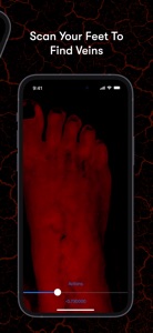 X-Vein screenshot #5 for iPhone