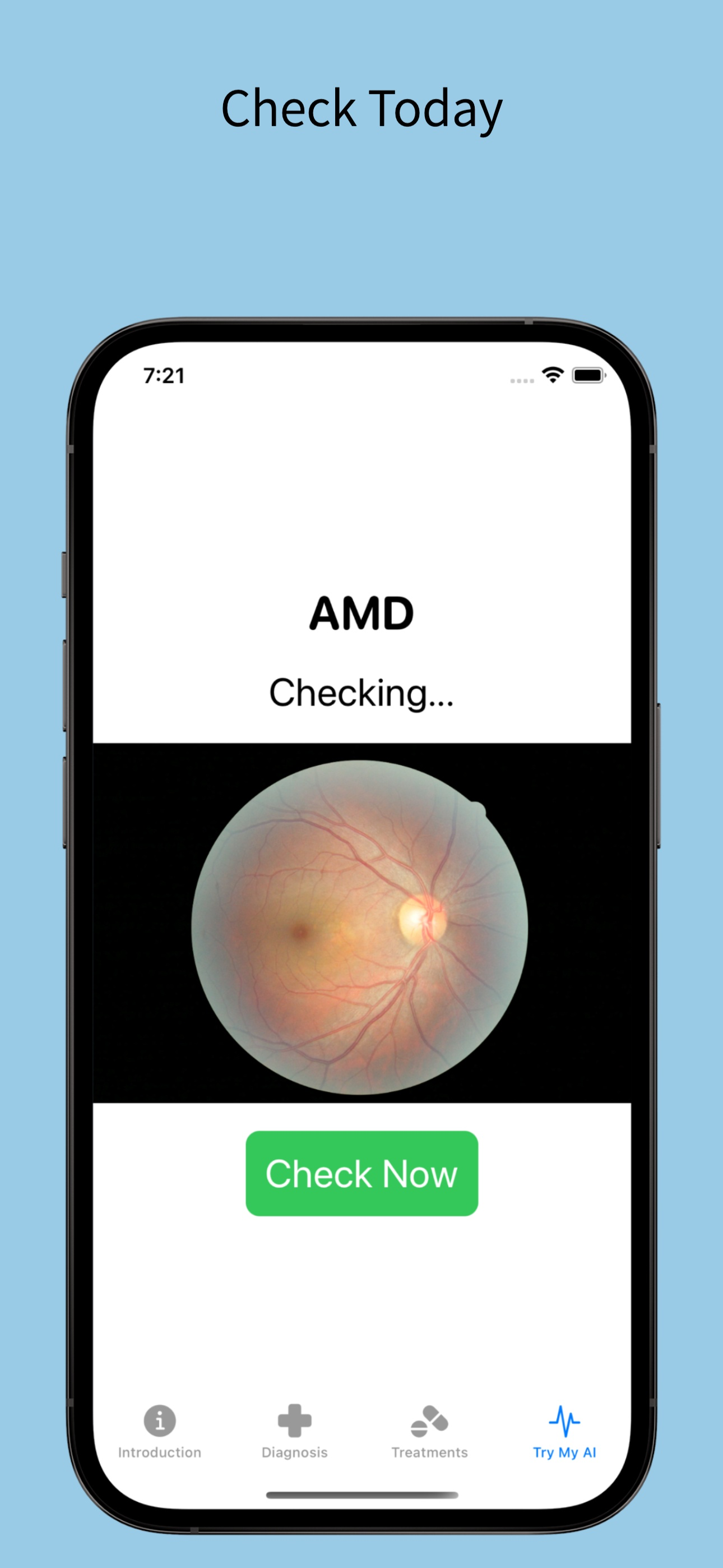 AMD Detection