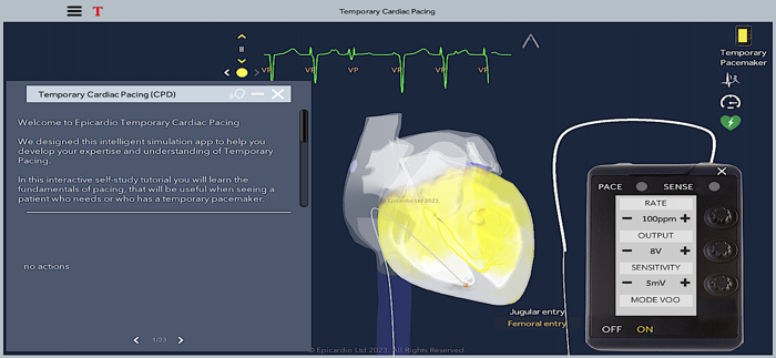 Temporary Cardiac Pacing