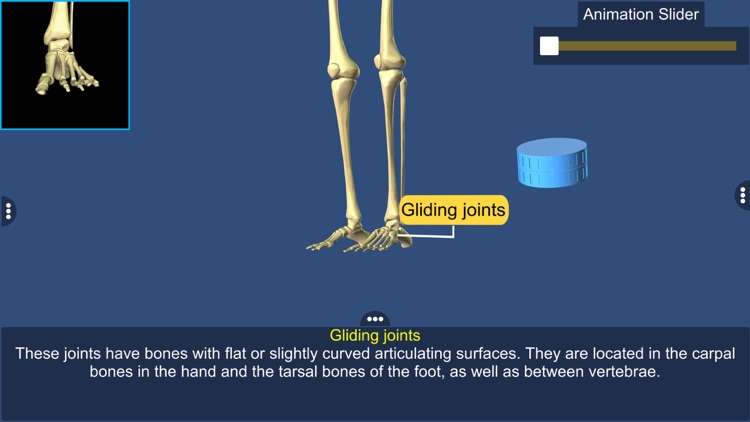 Joints: The Human Levers screenshot-6