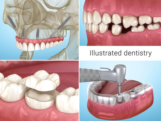 Dental 3D Illustrations iPad screenshot 5 - Medical app
