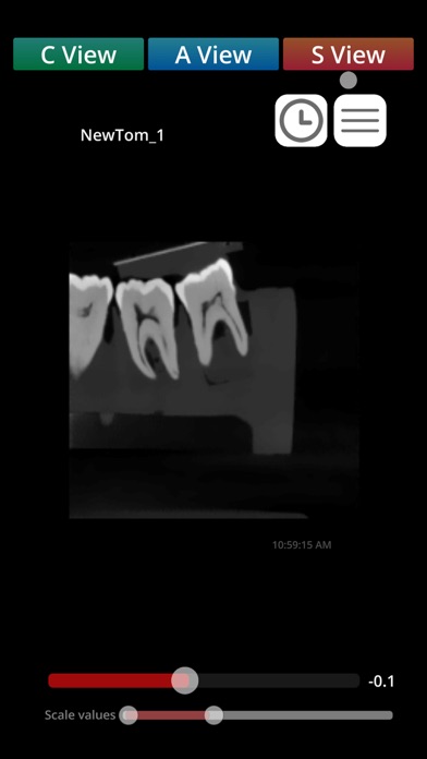 Zumax Dicom Viewer - CN Screenshot