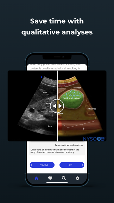 Point of Care Ultrasound Screenshot