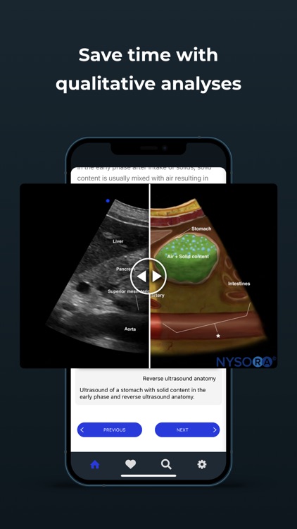 Point of Care Ultrasound screenshot-4