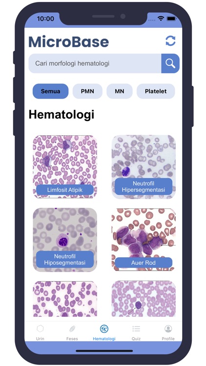 MicroBase screenshot-3