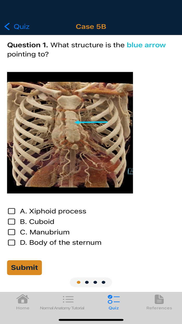 CTisus Chest Atlas 3D CRT