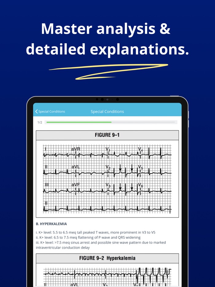 ECG EKG Interpretation Mastery
