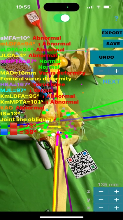 KneeNaviAR screenshot-3