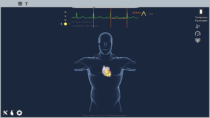 Temporary Cardiac Pacing