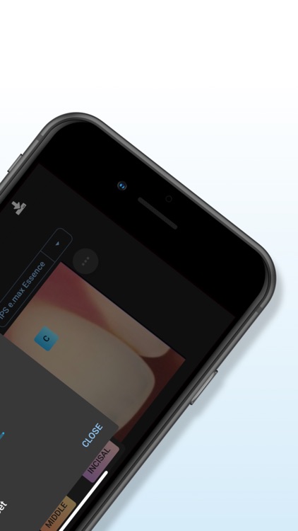 Matisse | Shade Matching