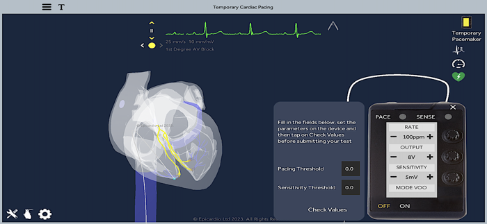 Temporary Cardiac Pacing