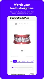 smiledirectclub problems & solutions and troubleshooting guide - 4