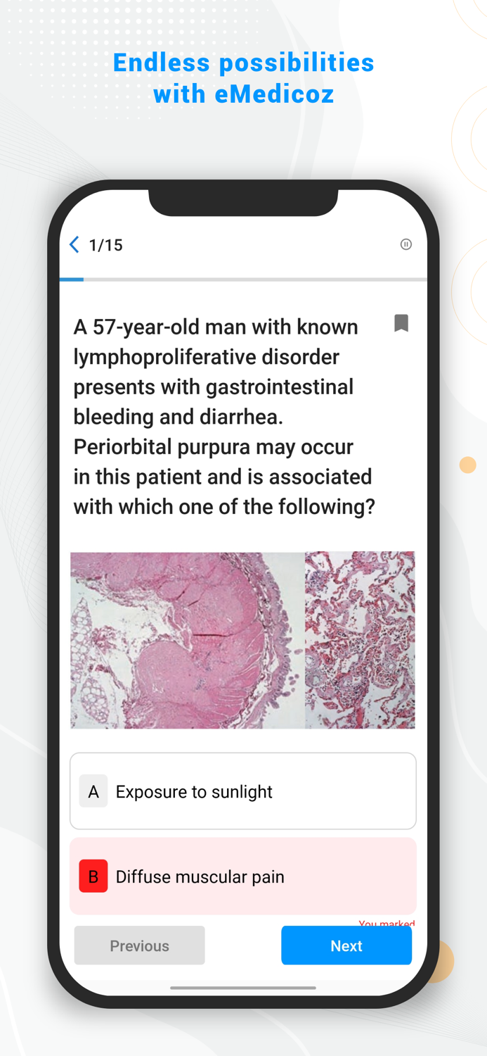 eMedicoz-NEET PG LIVE classes