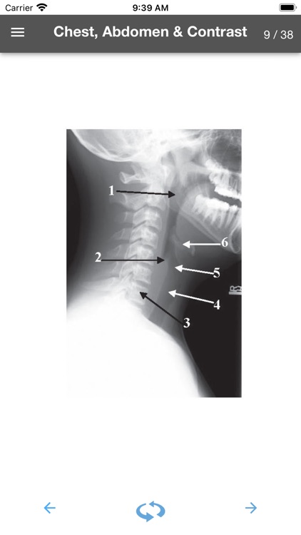 Rad Tech Flashcards - Images