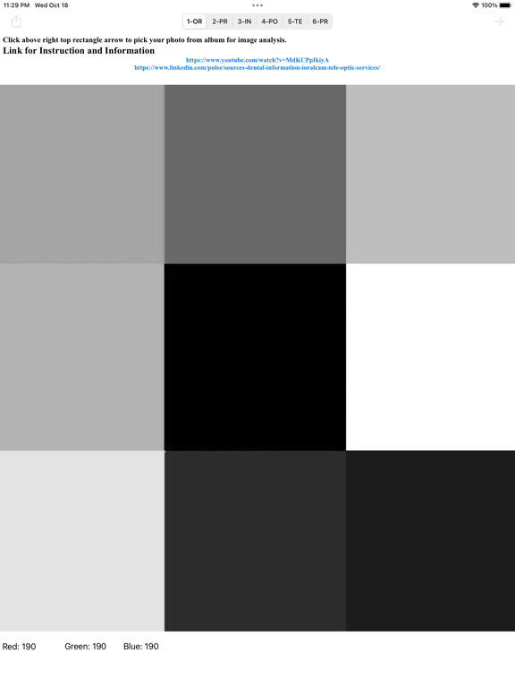 Screenshot #6 pour iOralCam