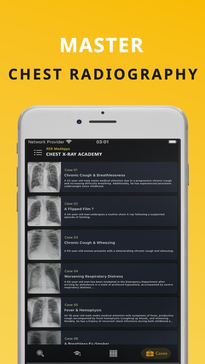 Chest X-ray Academy: Learn CXR screenshot-4