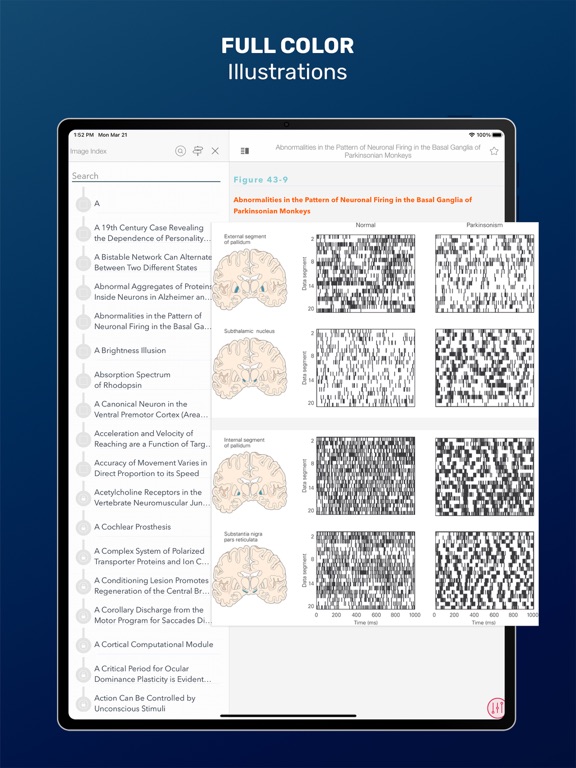 Screenshot #6 pour Principles of Neural Science