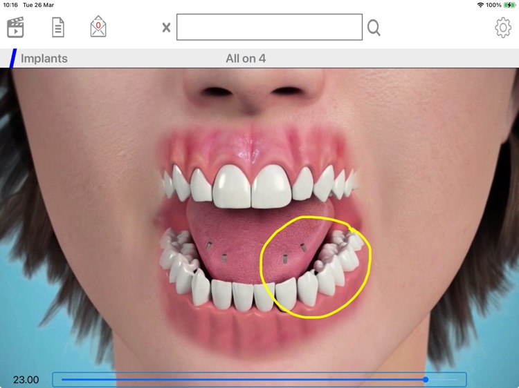 MEDiVision Communicator