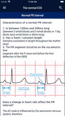 Game screenshot ECG APPtitude apk