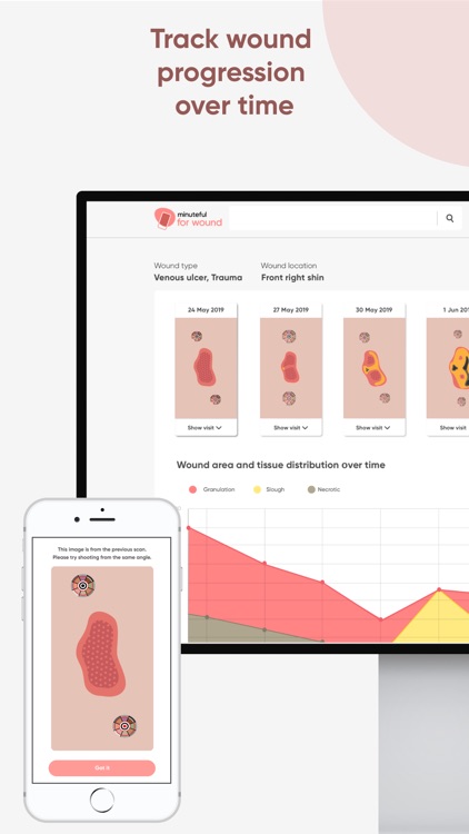 Minuteful for Wound screenshot-3