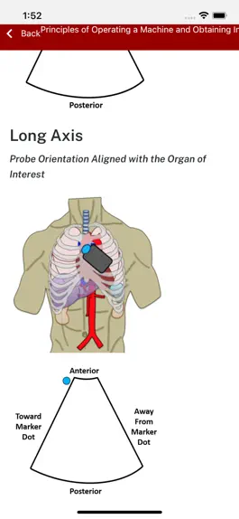 Game screenshot IU - POCUS apk