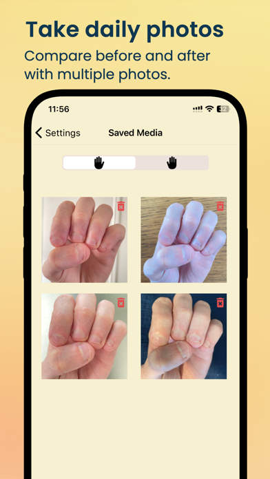 NailKeeper - Stop Biting Nails Screenshot