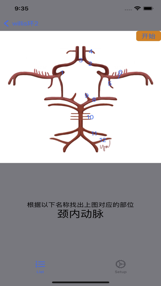 #4. 脑血管学习 (iOS) 게시자: 艺 张
