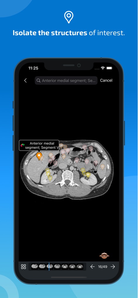 IMAIOS e-Anatomy - This feature allows medical professionals to isolate structures of interest with interactive pins, such as the 'Anterior medial segment', and review them across multiple slices via the intuitive image series navigation.