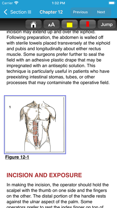 Zollinger Atlas of Surgery 11Eのおすすめ画像6